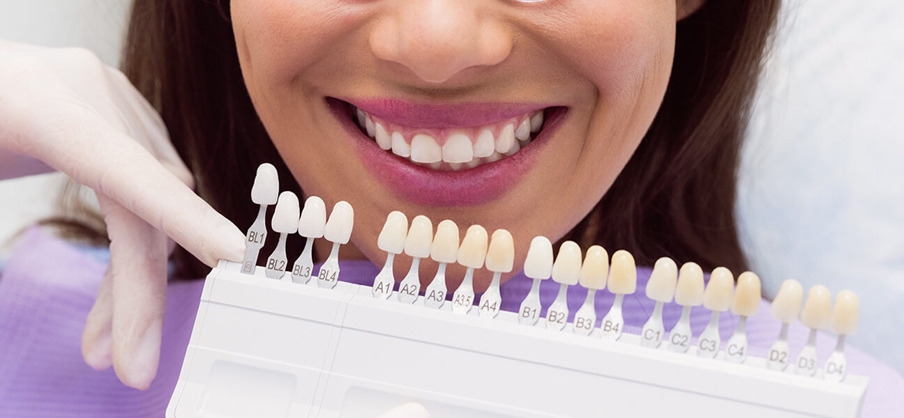 Top 5 Causes of Veneer Breath and How to Solve Them