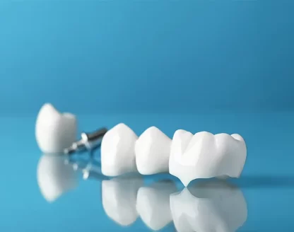 When Should a Filling Be Replaced With a Crown? 