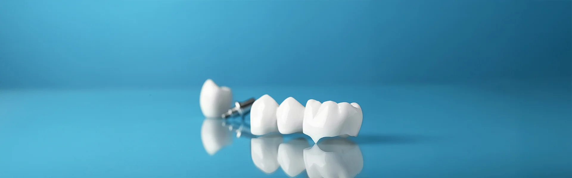 When Should a Filling Be Replaced With a Crown?