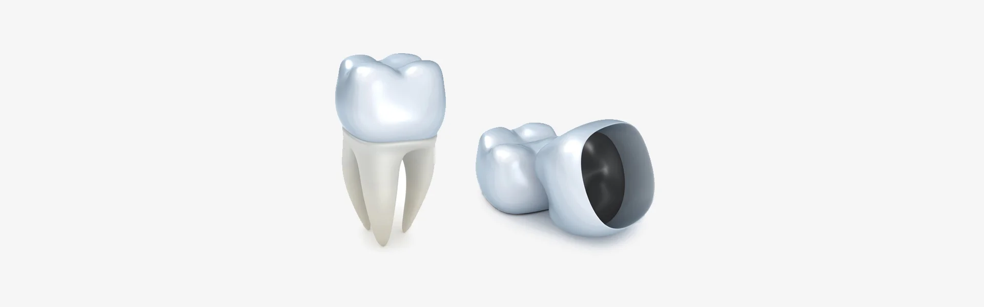 When Do You Need a Dental Crown? What Patients Should Know